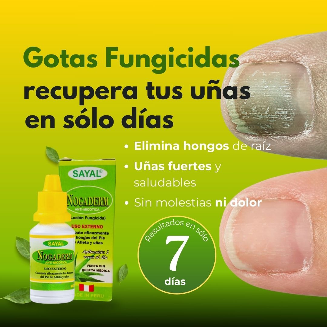 Pack Antihongos Crema + Gotas + Regalo