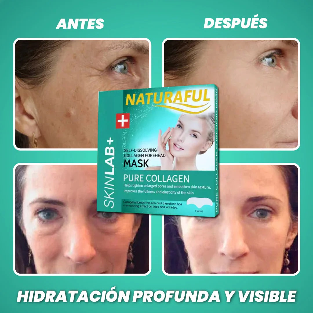 NaturaFul® Parches De Colágeno Absorbentes PROMO 2x1