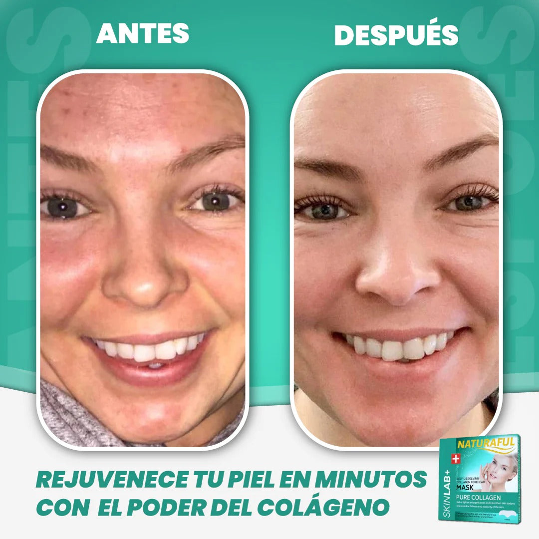 NaturaFul® Parches De Colágeno Absorbentes PROMO 2x1