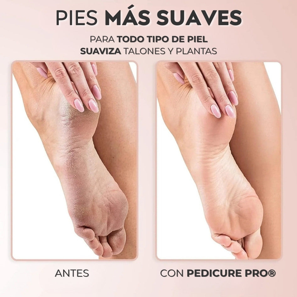 PEDICURE PRO® Removedor de Callos Inalámbrico
